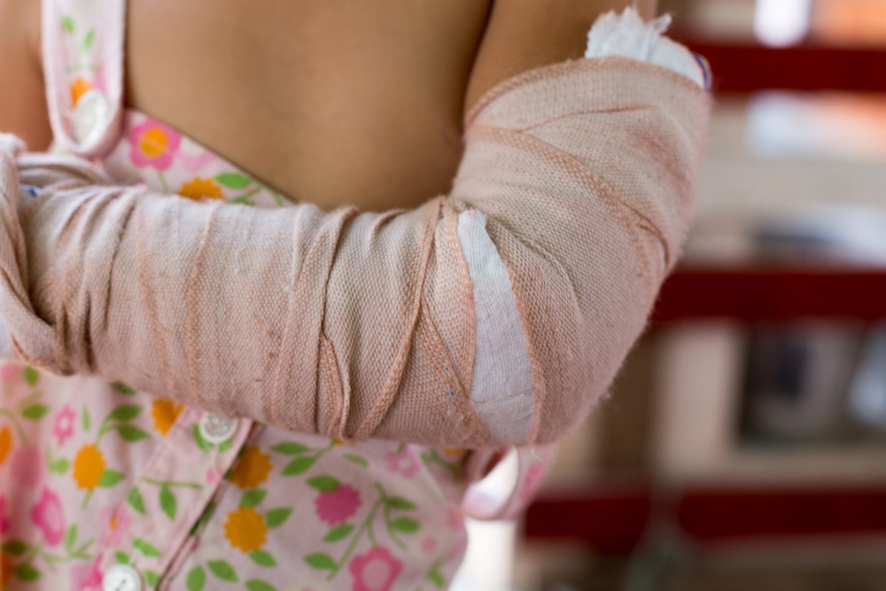 Florence Personal Injury Lawyer