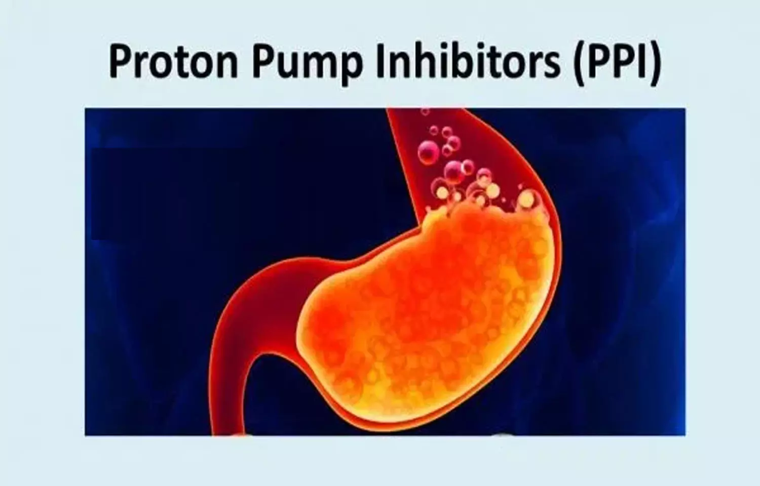 South Carolina Proton Pump Inhibitors Lawyer