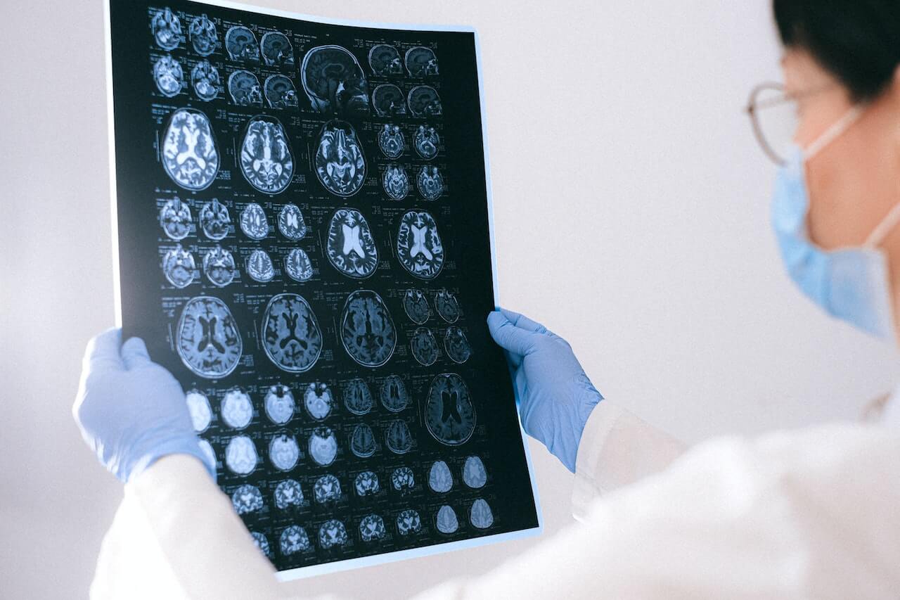 How Long Can the Effects of a Traumatic Brain Injury Last?